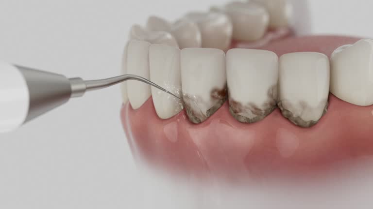 Trusted Dental Crowns And Bridges service in Lewistown, IL - Dentist Open Now